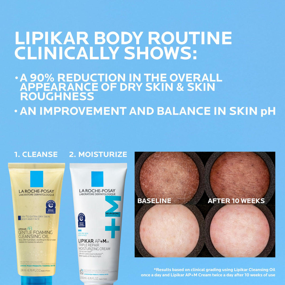 La Roche-Posay Lipikar AP+MAX Triple Repair Moisturizing Body Cream | Face & Body Lotion for Dry Skin with Shea Butter & Niacinamide | Gentle Moisturizer for Very Dry, Rough & Sensitive Skin-La Roche-Posay Lipikar AP+MAX Triple Repair Moisturizing Body Cream | Face & Body Lotion for Dry Skin with Shea Butter & Niacinamide | Gentle Moisturizer for Very Dry, Rough & Sensitive Skin