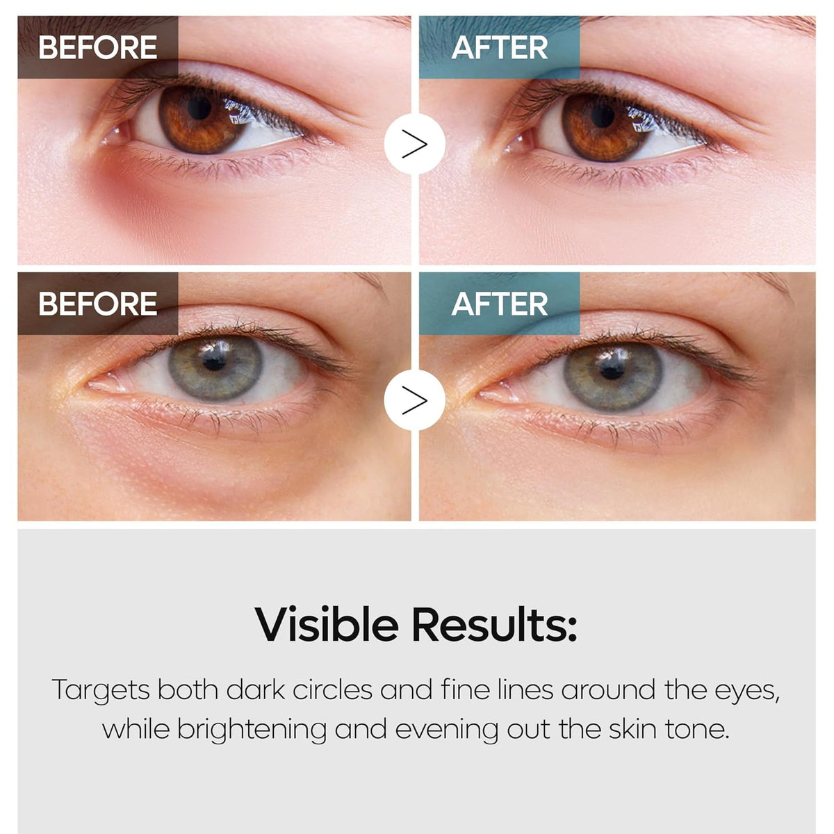 Dr. Melaxin TX Retinalsome Double Effect Eye Cream-Dr. Melaxin TX Retinalsome Double Effect Eye Cream