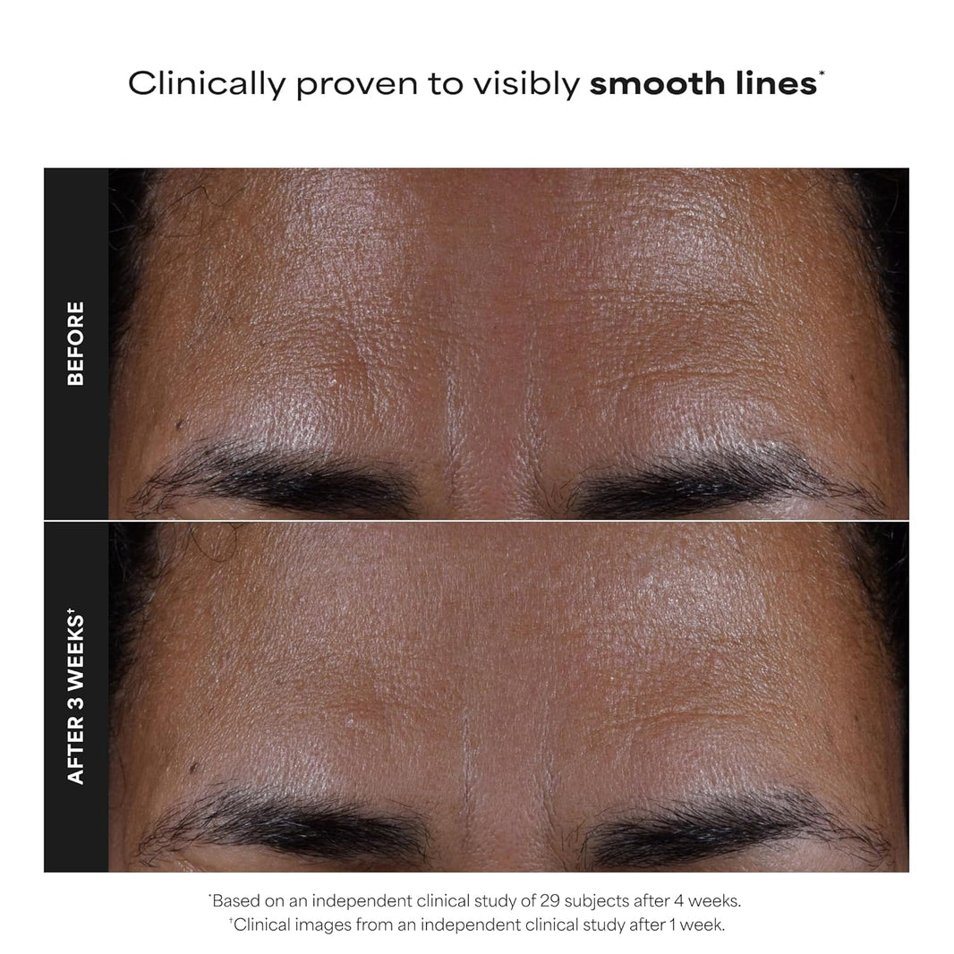 Paula's Choice SKIN PERFECTING 2% BHA Liquid Exfoliant with Salicylic Acid, Facial Polish for Pores, Wrinkles & Fine Lines, Suitable for Blackhead-Prone Skin, Fragrance-Free-Paula's Choice SKIN PERFECTING 2% BHA Liquid Exfoliant with Salicylic Acid, Facial Polish for Pores, Wrinkles & Fine Lines, Suitable for Blackhead-Prone Skin, Fragrance-Free
