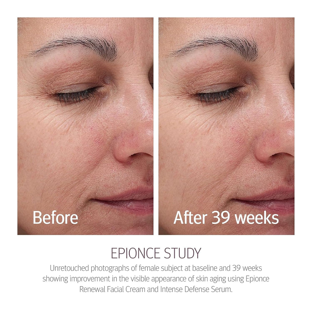 Epionce Renewal Facial Cream – Hydrating Anti-Aging Moisturizer | For Dry, Sensitive to Normal Skin | Fine Lines & Wrinkles | Dermatologist Skincare-Epionce Renewal Facial Cream – Hydrating Anti-Aging Moisturizer | For Dry, Sensitive to Normal Skin | Fine Lines & Wrinkles | Dermatologist Skincare