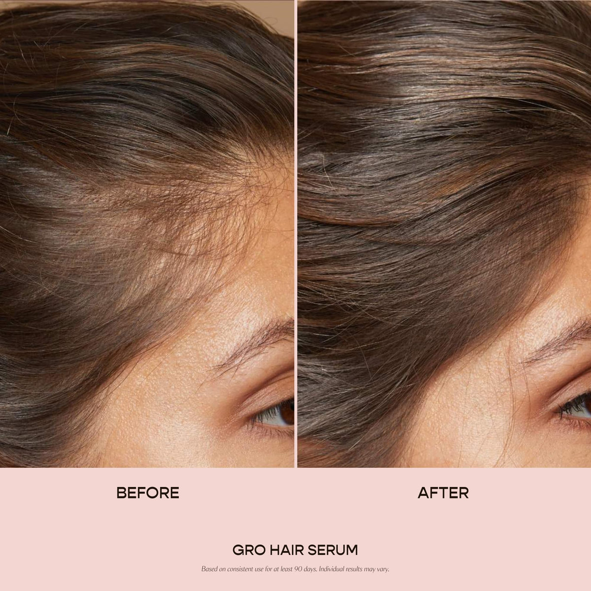 VEGAMOUR GRO Hair Serum for Hair Thinning & Shedding, Thicker Fuller Looking Hair In As Soon As 90 Days, Non Oily, Bergamot Scent, Vegan & Cruelty Free-VEGAMOUR GRO Hair Serum for Hair Thinning & Shedding, Thicker Fuller Looking Hair In As Soon As 90 Days, Non Oily, Bergamot Scent, Vegan & Cruelty Free