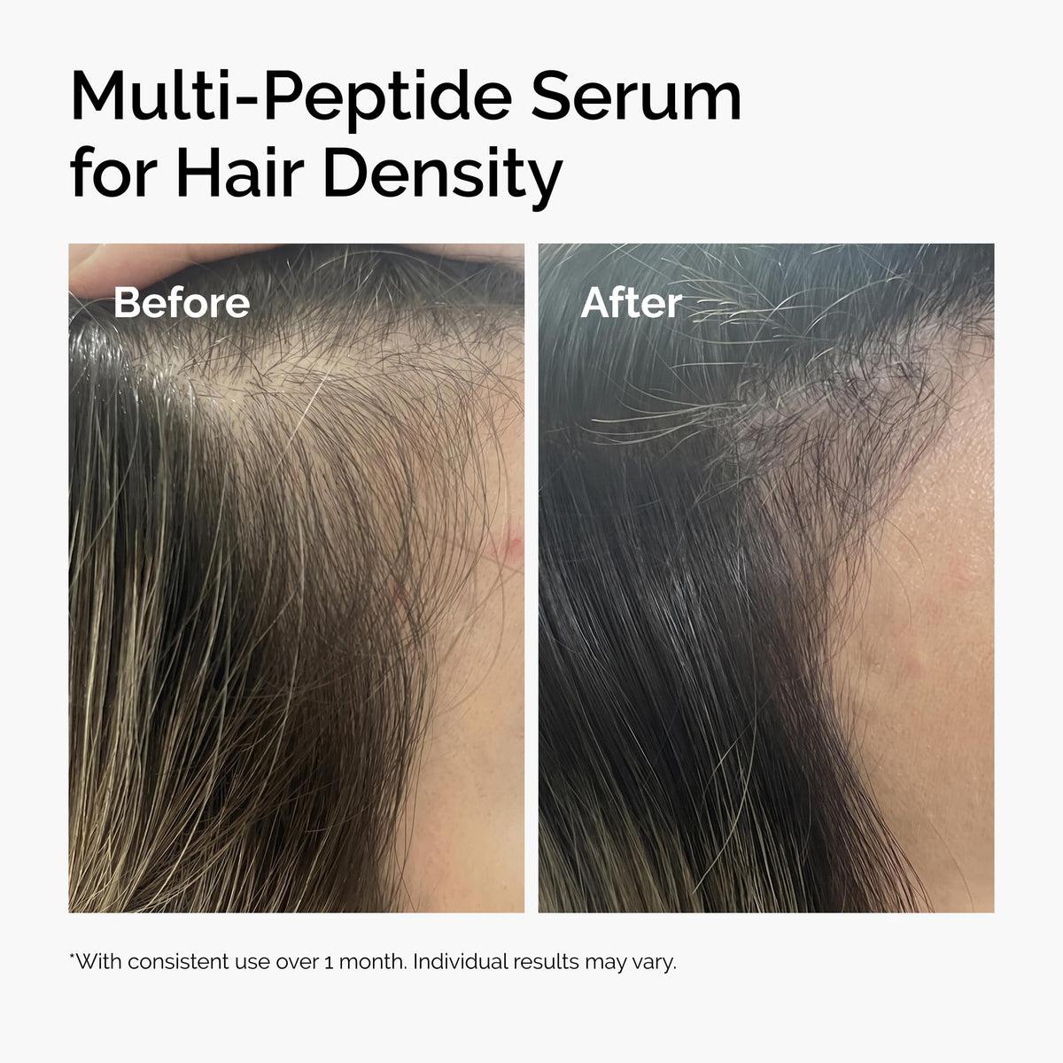 The Ordinary Multi-Peptide Serum for Hair Density, Peptide-Powered Formula for Thicker, Fuller Looking Hair-The Ordinary Multi-Peptide Serum for Hair Density, Peptide-Powered Formula for Thicker, Fuller Looking Hair