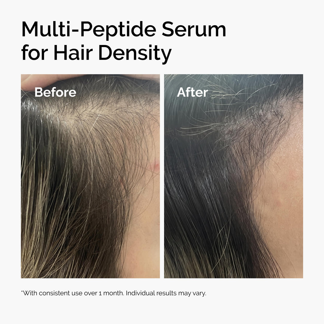 The Ordinary Multi-Peptide Serum for Hair Density, Peptide-Powered Formula for Thicker, Fuller Looking Hair-The Ordinary Multi-Peptide Serum for Hair Density, Peptide-Powered Formula for Thicker, Fuller Looking Hair