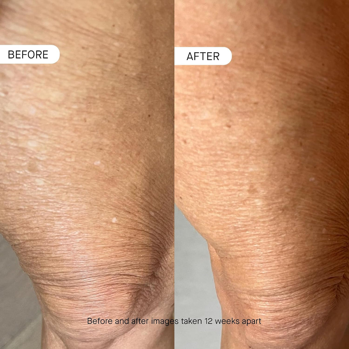 OneSkin BODY OS-01 Peptide Topical Supplement & Skin Longevity Age Reversal Moisturizer | Safe for Sensitive Skin, Fragrance-Free, 250 mL / 8.45 oz-OneSkin BODY OS-01 Peptide Topical Supplement & Skin Longevity Age Reversal Moisturizer | Safe for Sensitive Skin, Fragrance-Free, 250 mL / 8.45 oz