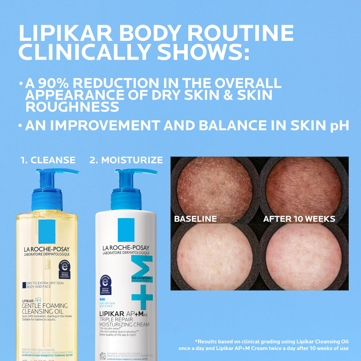 La Roche-Posay Lipikar AP+MAX Triple Repair Moisturizing Body Cream | Face & Body Lotion for Dry Skin with Shea Butter & Niacinamide | Gentle Moisturizer for Very Dry, Rough & Sensitive Skin-La Roche-Posay Lipikar AP+MAX Triple Repair Moisturizing Body Cream | Face & Body Lotion for Dry Skin with Shea Butter & Niacinamide | Gentle Moisturizer for Very Dry, Rough & Sensitive Skin