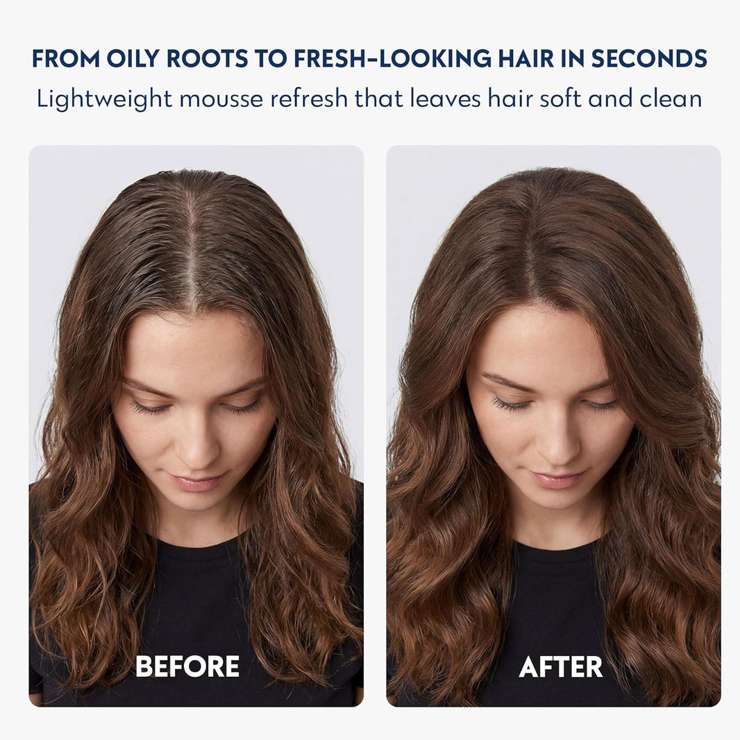 Sensitive Dry Shampoo Foam-Sensitive Dry Shampoo Foam