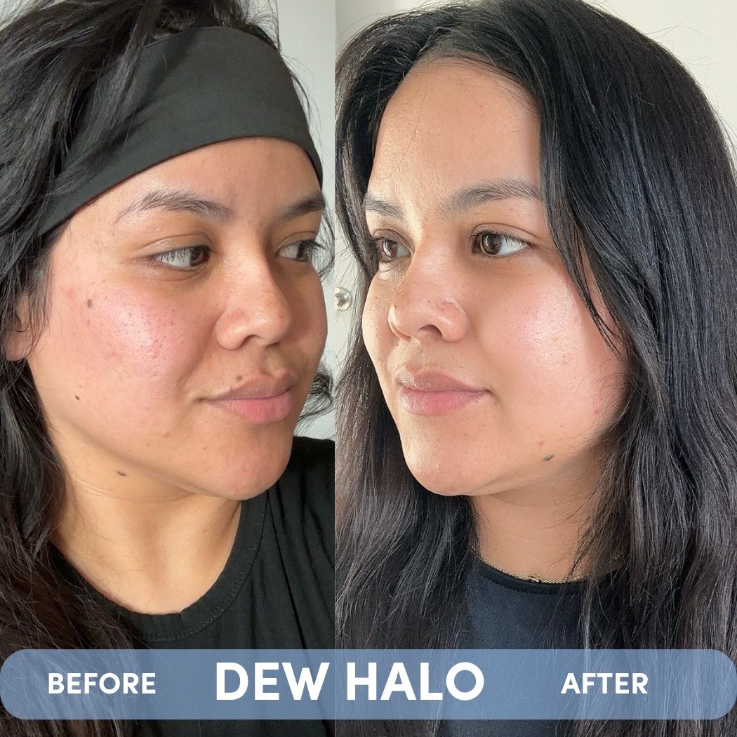 DEW HALO-DEW HALO