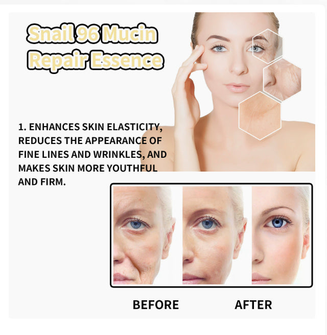 Snail 96 Mucin Repair-3ae556235a65e9464c797c366b565f45