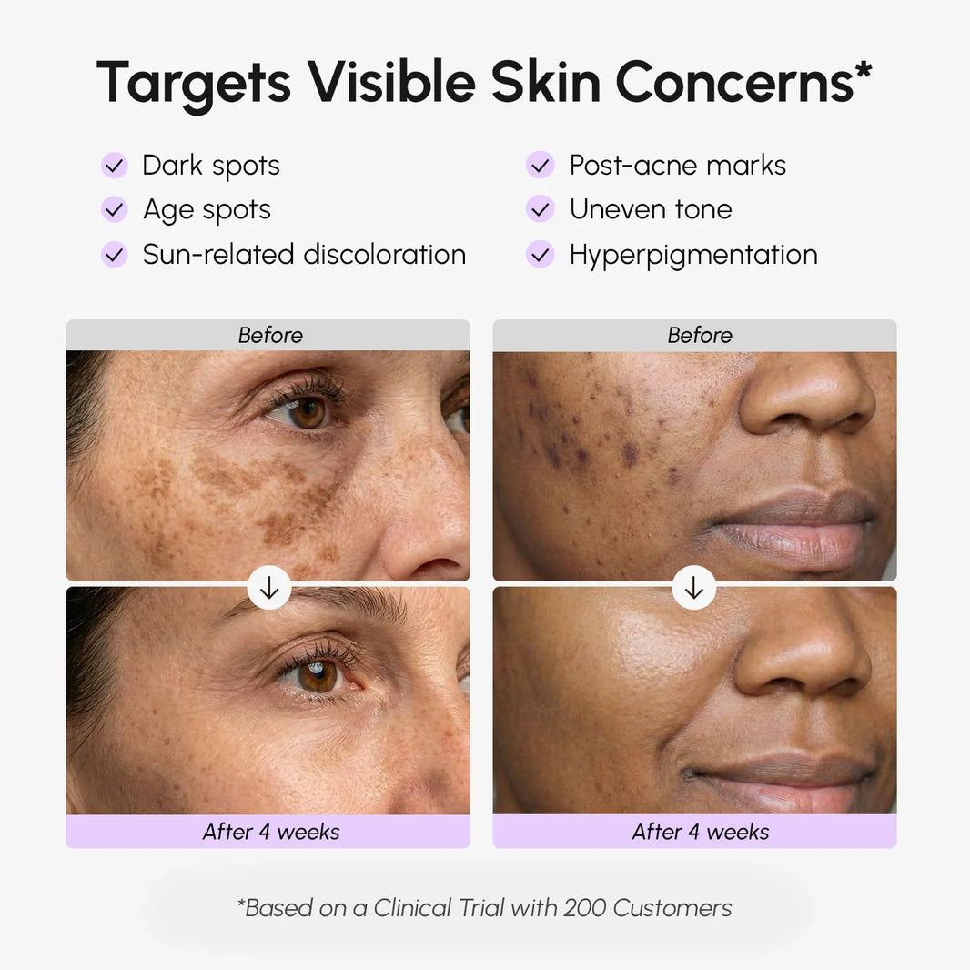 Face & Body Serum for Dark Spots-Face & Body Serum for Dark Spots
