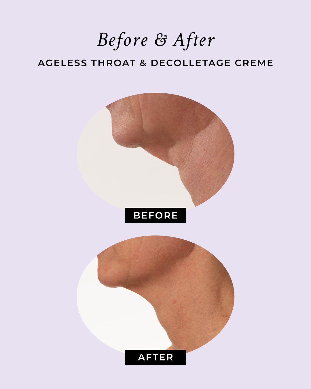 Ageless Throat & Decolletage Anti-Aging Neck Creme-Ageless Throat & Decolletage Anti-Aging Neck Creme
