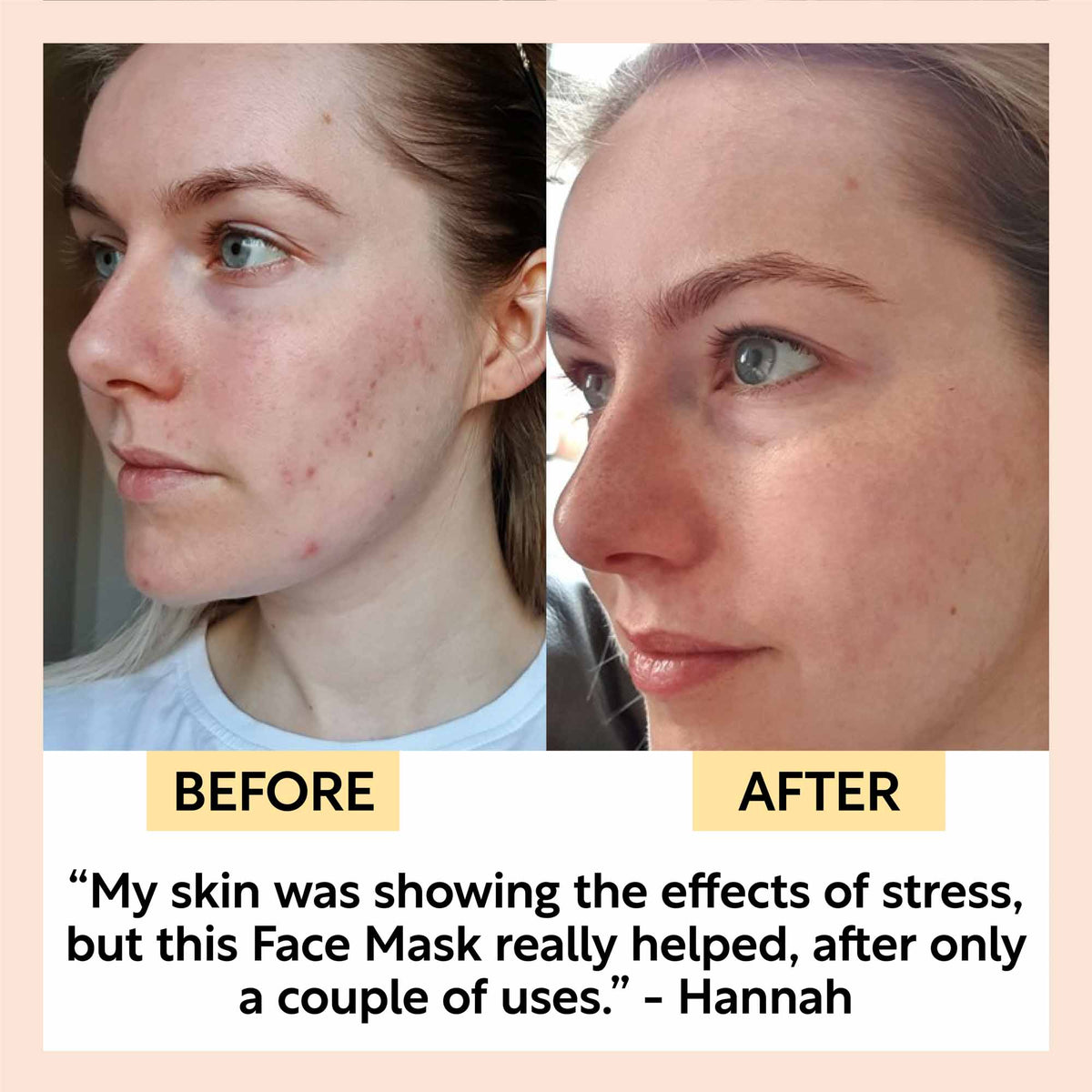 Kaolin Clay Face Mask-Kaolin Clay Face Mask