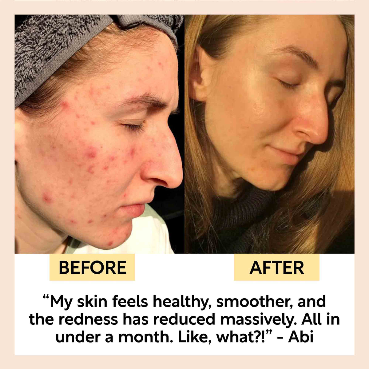 Kaolin Clay Face Mask-Kaolin Clay Face Mask
