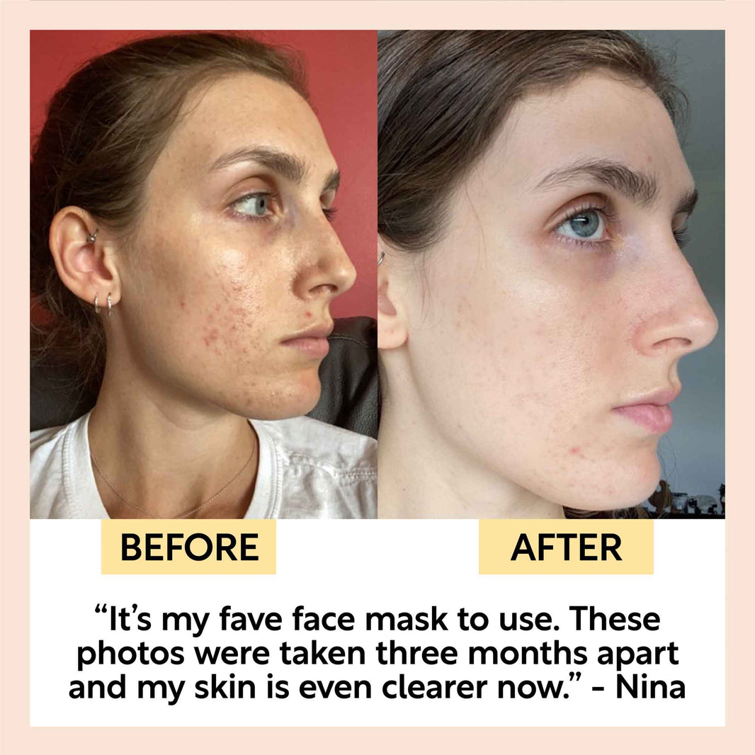 Kaolin Clay Face Mask-Kaolin Clay Face Mask