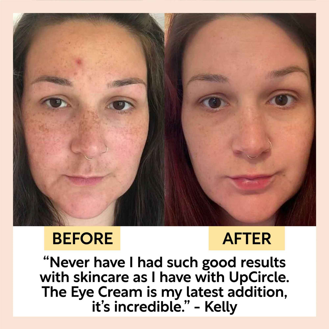 Eye Cream with Hyaluronic Acid & Coffee-Eye Cream with Hyaluronic Acid & Coffee