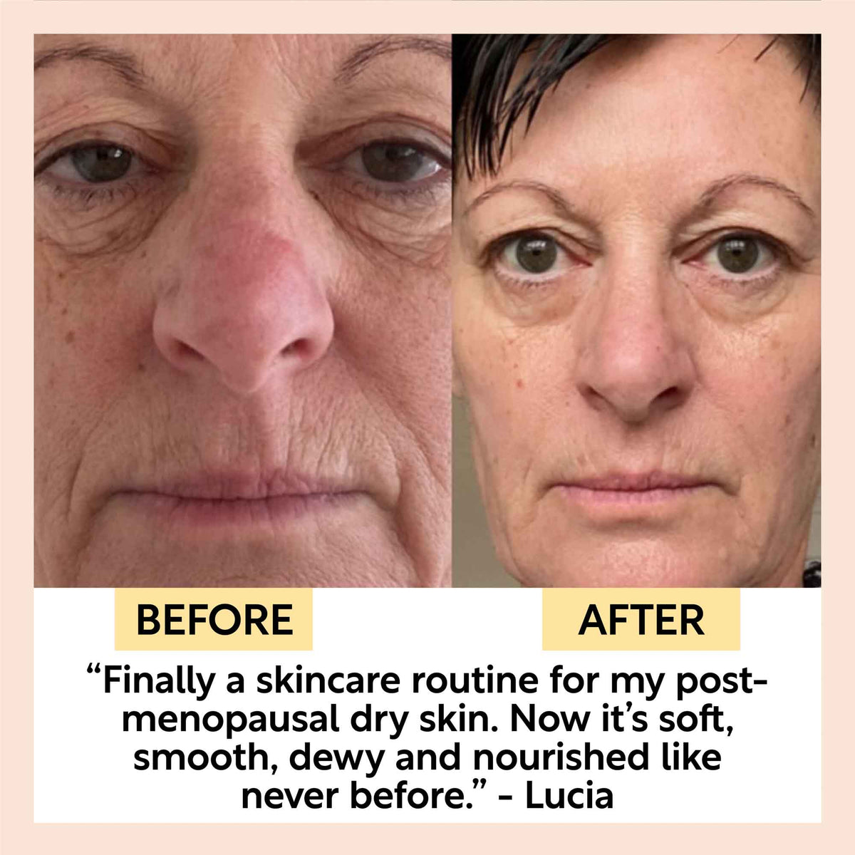 Eye Cream with Hyaluronic Acid & Coffee-Eye Cream with Hyaluronic Acid & Coffee