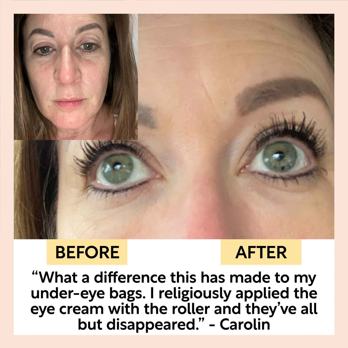 Eye Cream with Hyaluronic Acid & Coffee-Eye Cream with Hyaluronic Acid & Coffee