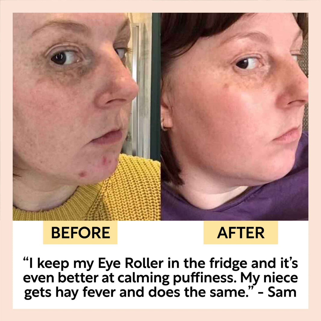 Soothing Eye Roller-Soothing Eye Roller