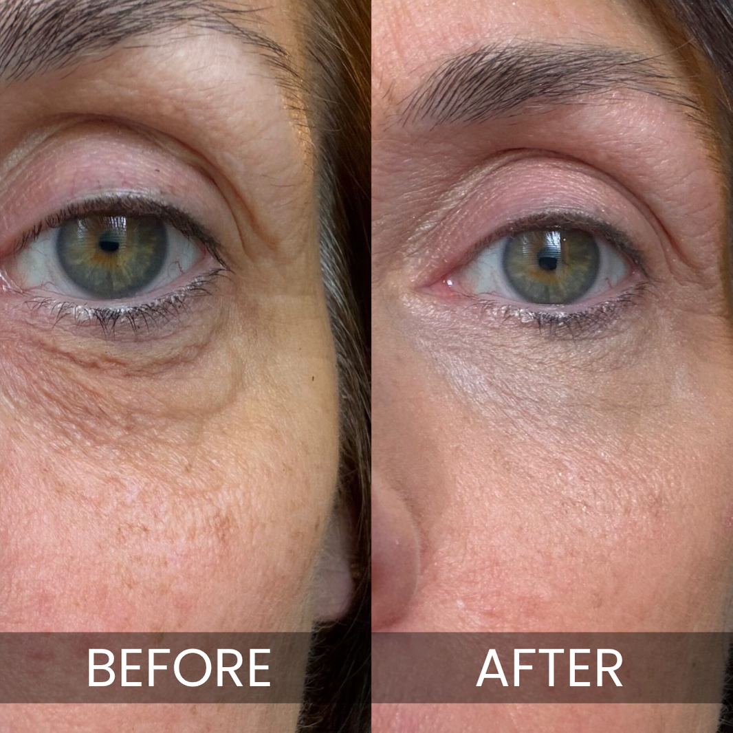 Luxe - Korean Under-Eye Balm-Luxe - Korean Under-Eye Balm