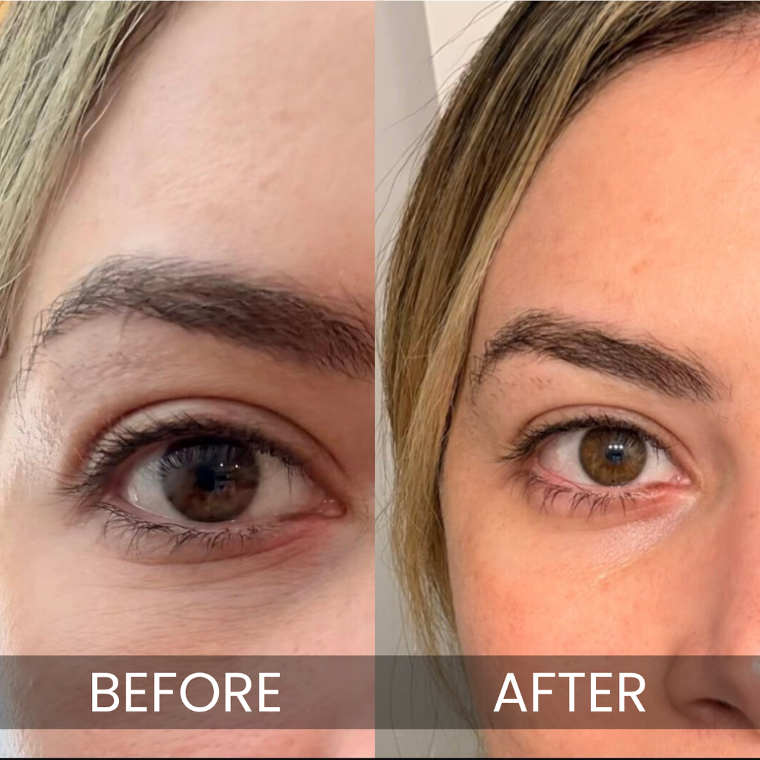Luxe - Korean Under-Eye Balm-Luxe - Korean Under-Eye Balm
