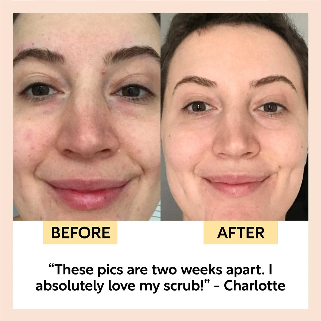 Face Scrub with Coffee + Rosehip Oil-Face Scrub with Coffee + Rosehip Oil