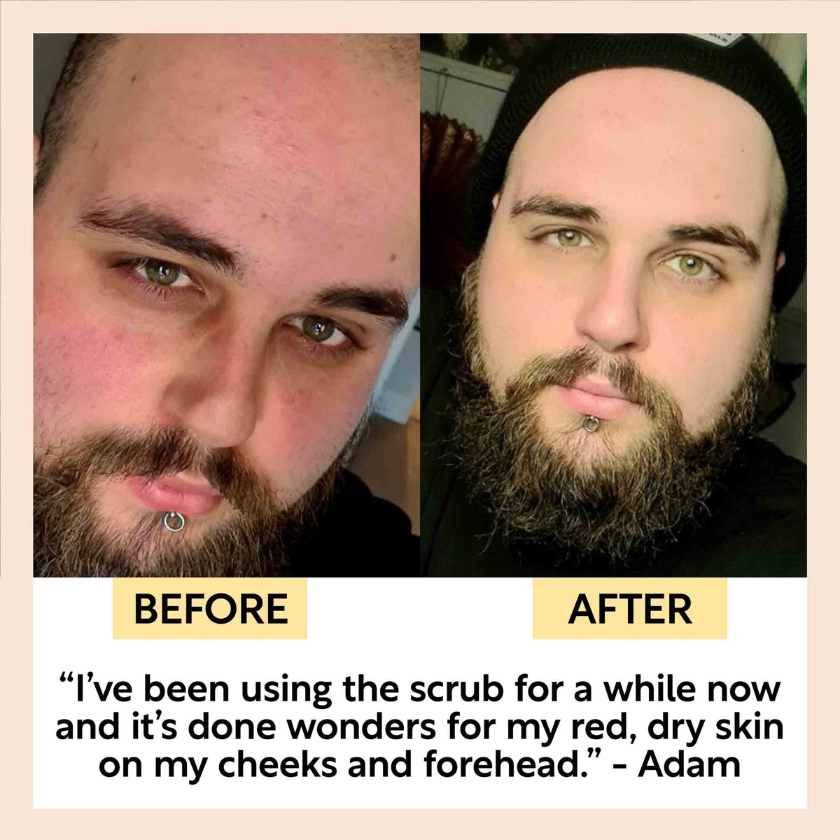 Face Scrub with Coffee + Rosehip Oil-Face Scrub with Coffee + Rosehip Oil