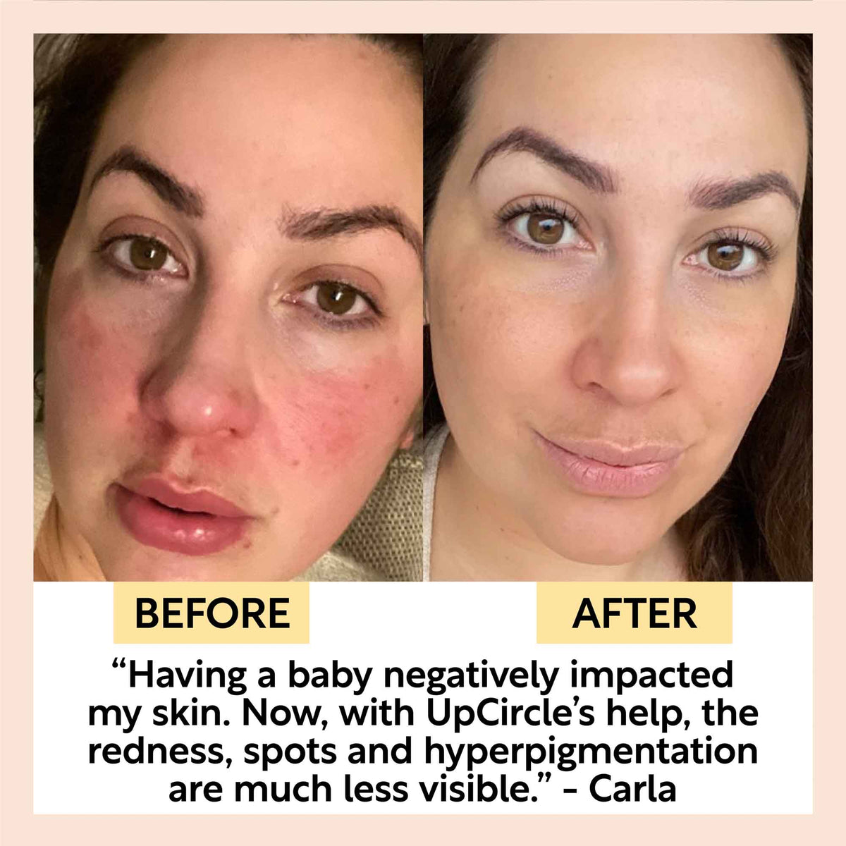 Day + Night Hydration Set-Day + Night Hydration Set