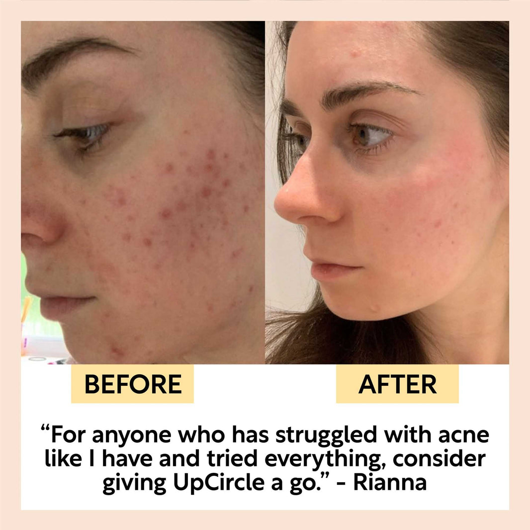 Face Toner with Hyaluronic Acid-Face Toner with Hyaluronic Acid