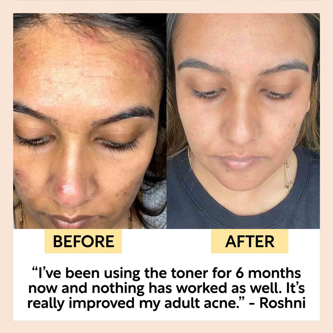 Face Toner with Hyaluronic Acid-Face Toner with Hyaluronic Acid