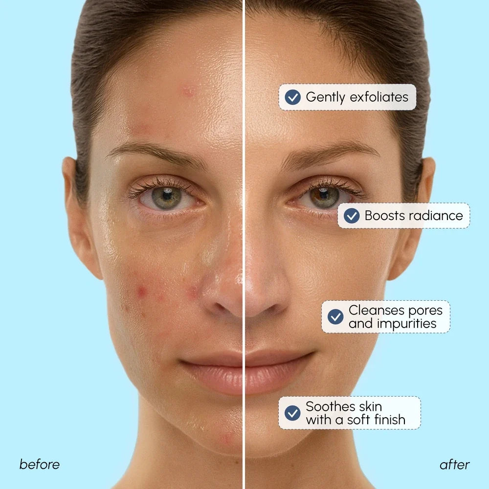 Face Polishing Scrub & Exfoliator-Face Polishing Scrub & Exfoliator