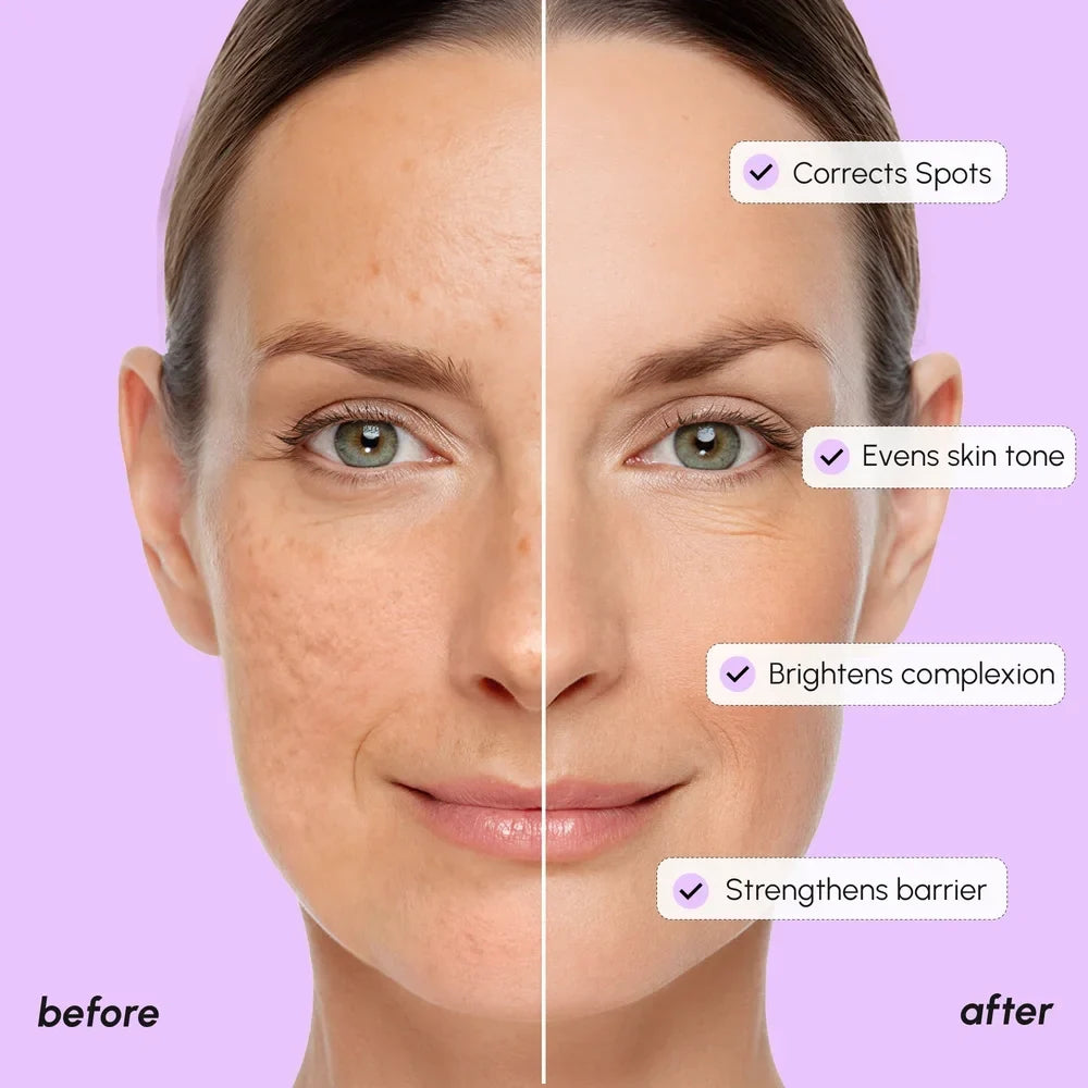 Dark Spot Corrector-Dark Spot Corrector