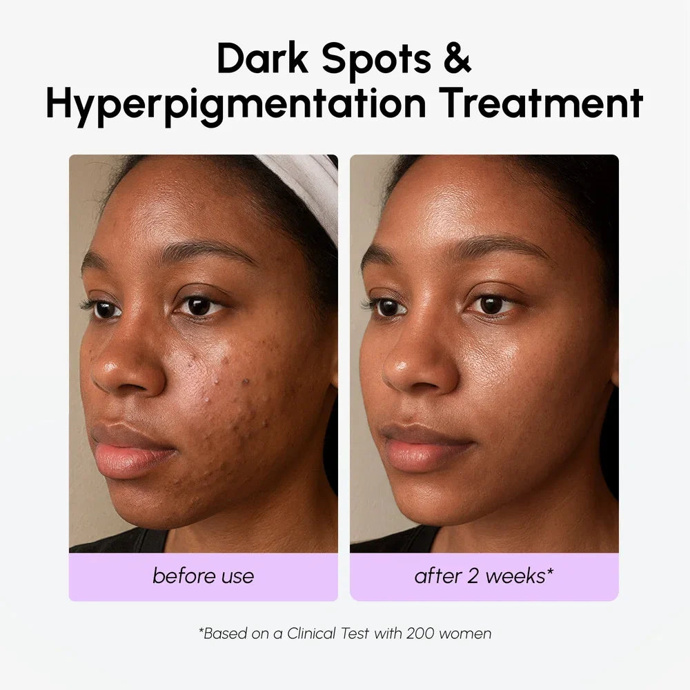 Dark Spot Corrector-Dark Spot Corrector