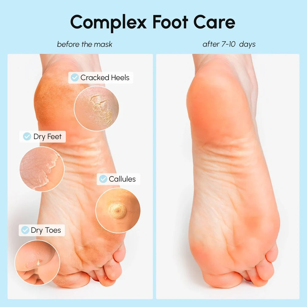 Exfoliating & Hydrating Foot Mask-Exfoliating & Hydrating Foot Mask