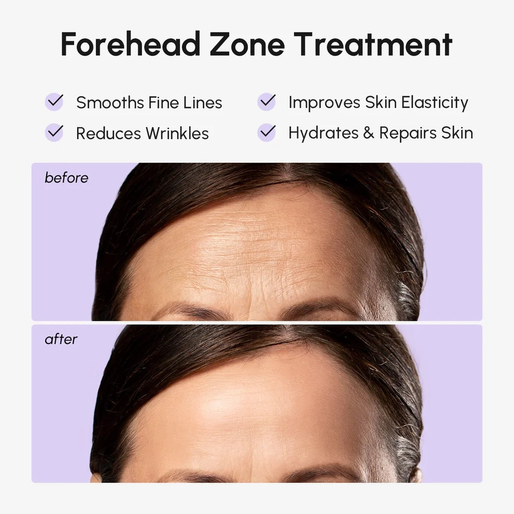 Anti-Wrinkle Forehead Patches-Anti-Wrinkle Forehead Patches