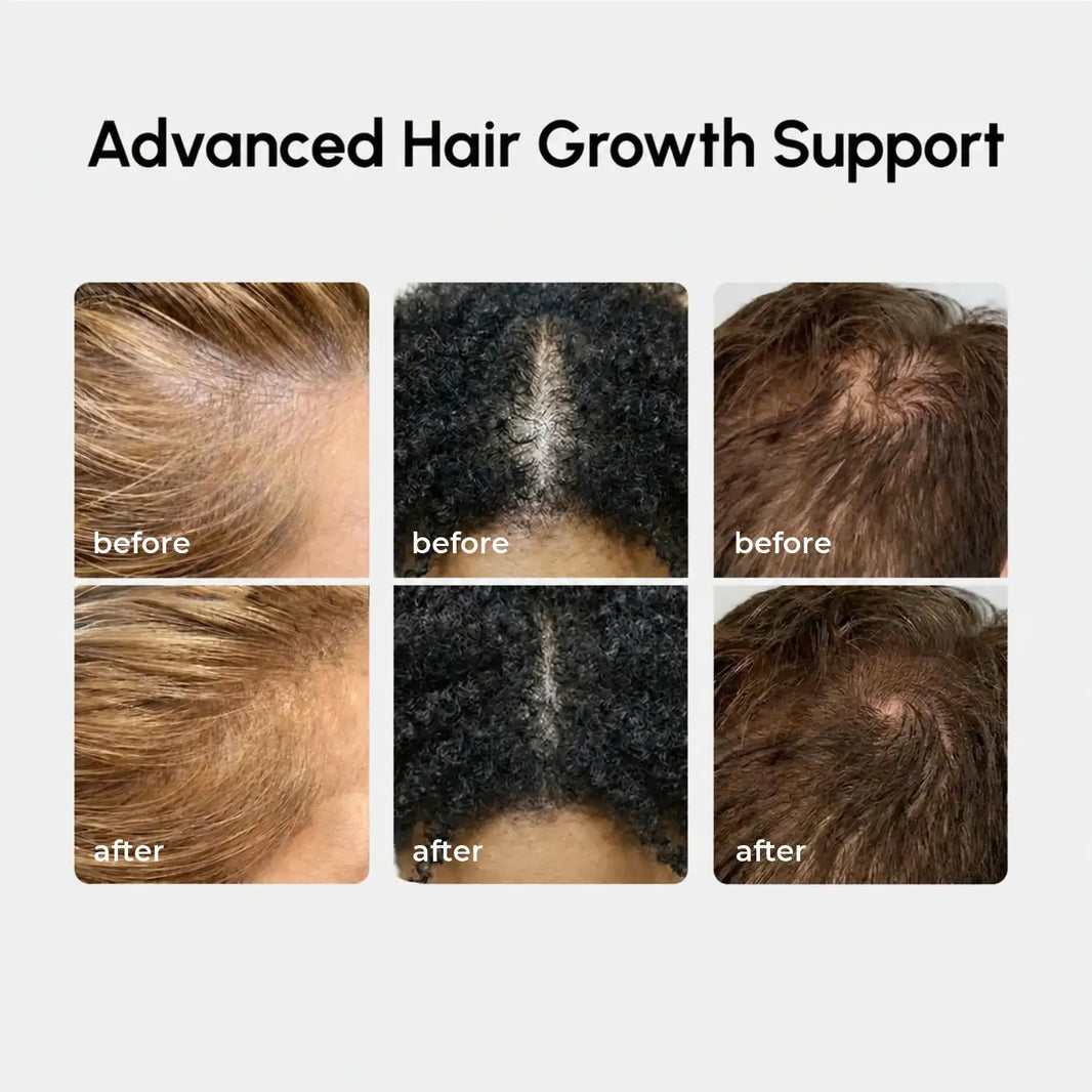 4-in-1 Hair Growth Spray-4-in-1 Hair Growth Spray