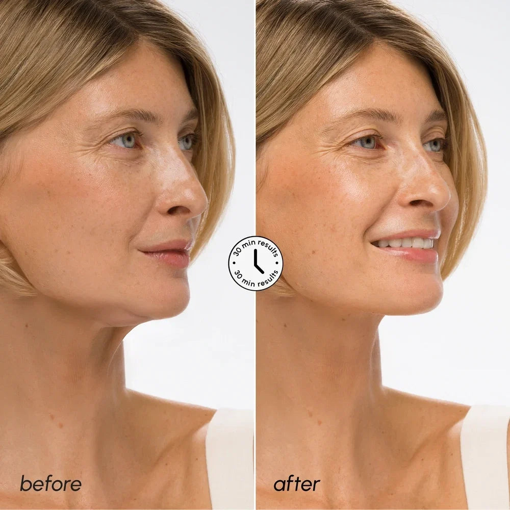 Hyaluronic Acid V-line Lifting Mask-Hyaluronic Acid V-line Lifting Mask