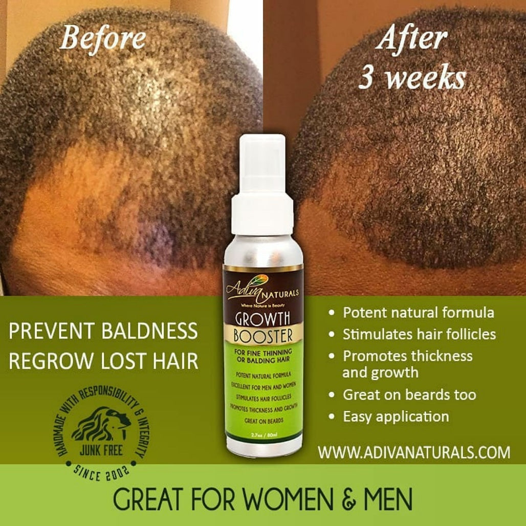 Hair Growth Booster (For Thinning or Balding Hair)-Hair Growth Booster (For Thinning or Balding Hair)