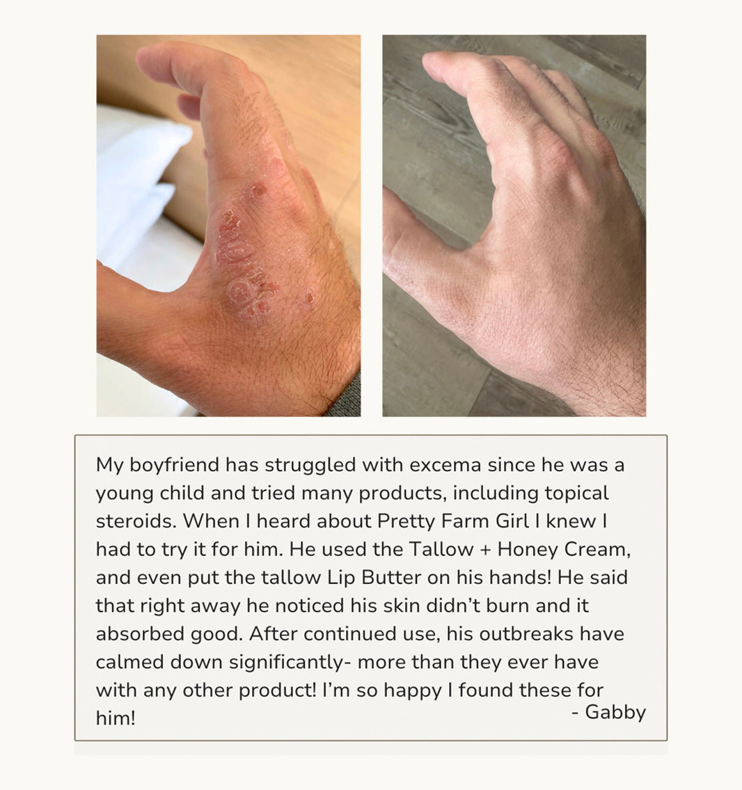 Fragrance Free Tallow + Honey Cream for Sensitive Skin-Fragrance Free Tallow + Honey Cream for Sensitive Skin