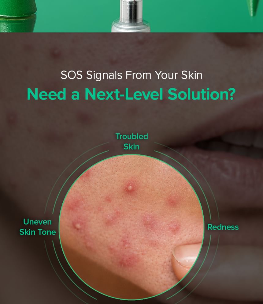 Mary & May Spicule Azelaic PDRN Spot Cream-Mary & May Spicule Azelaic PDRN Spot Cream