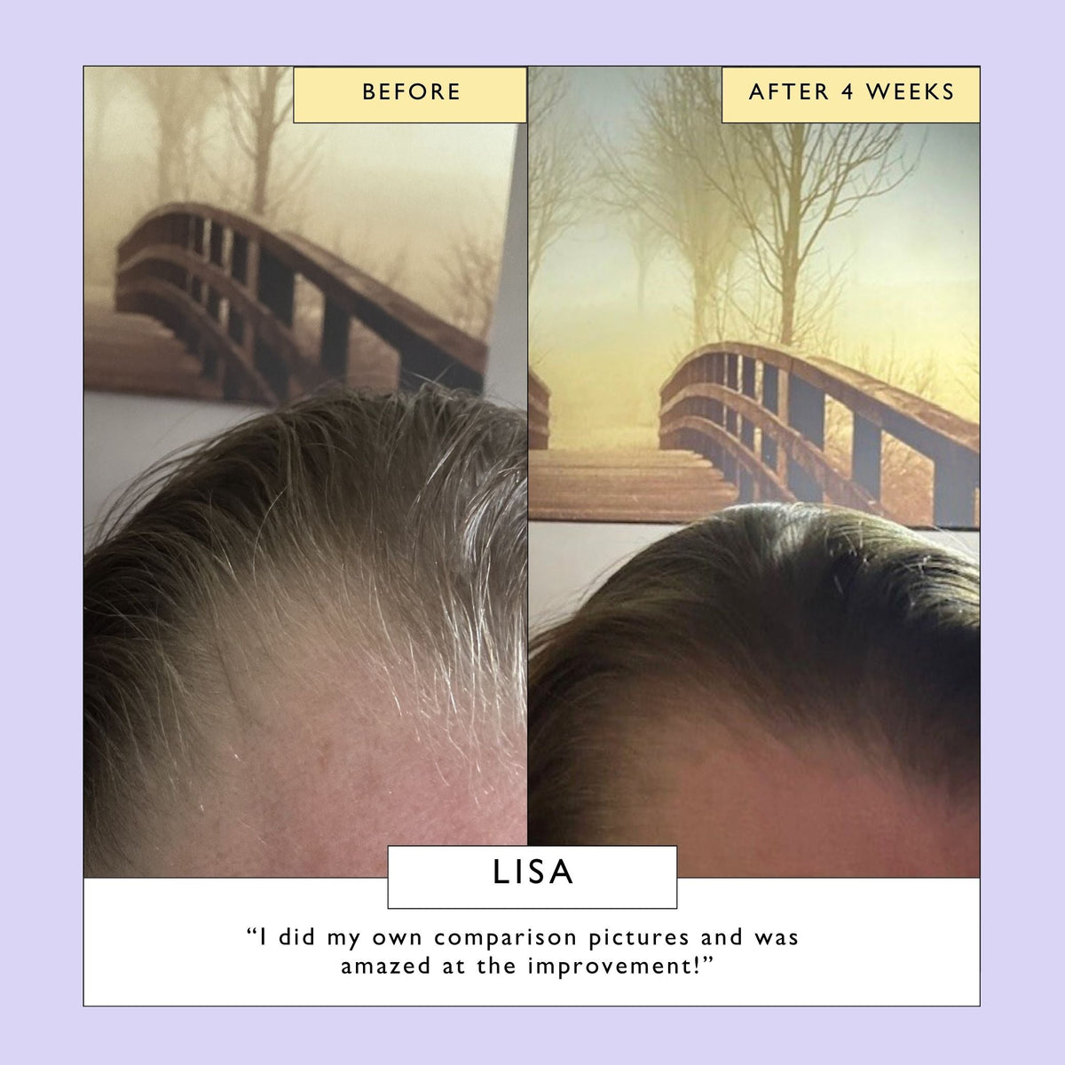 Scalp + Hair Oil with Bacuri Butter + Castor Oil-Scalp + Hair Oil with Bacuri Butter + Castor Oil