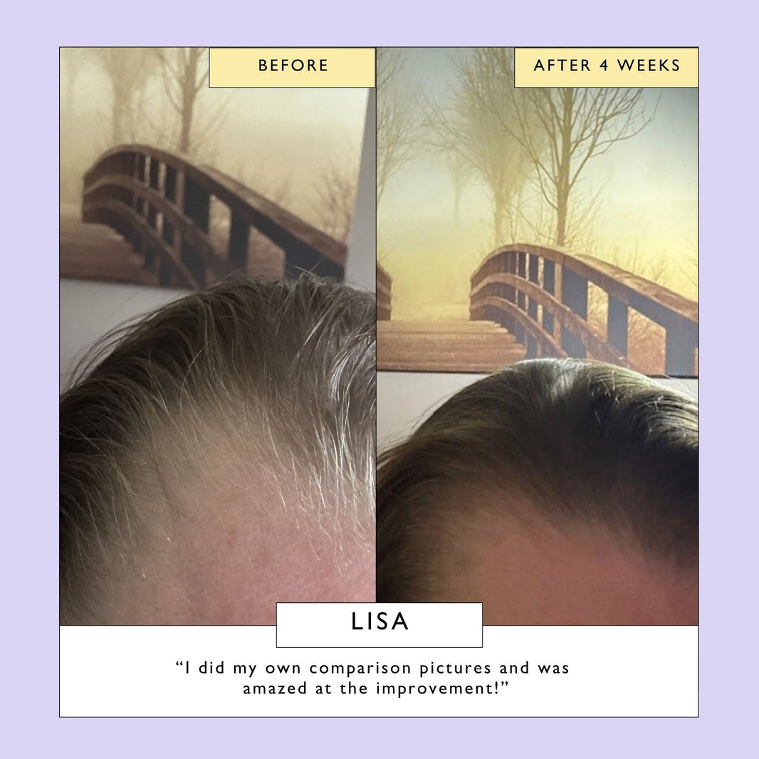 Scalp + Hair Oil with Bacuri Butter + Castor Oil-Scalp + Hair Oil with Bacuri Butter + Castor Oil