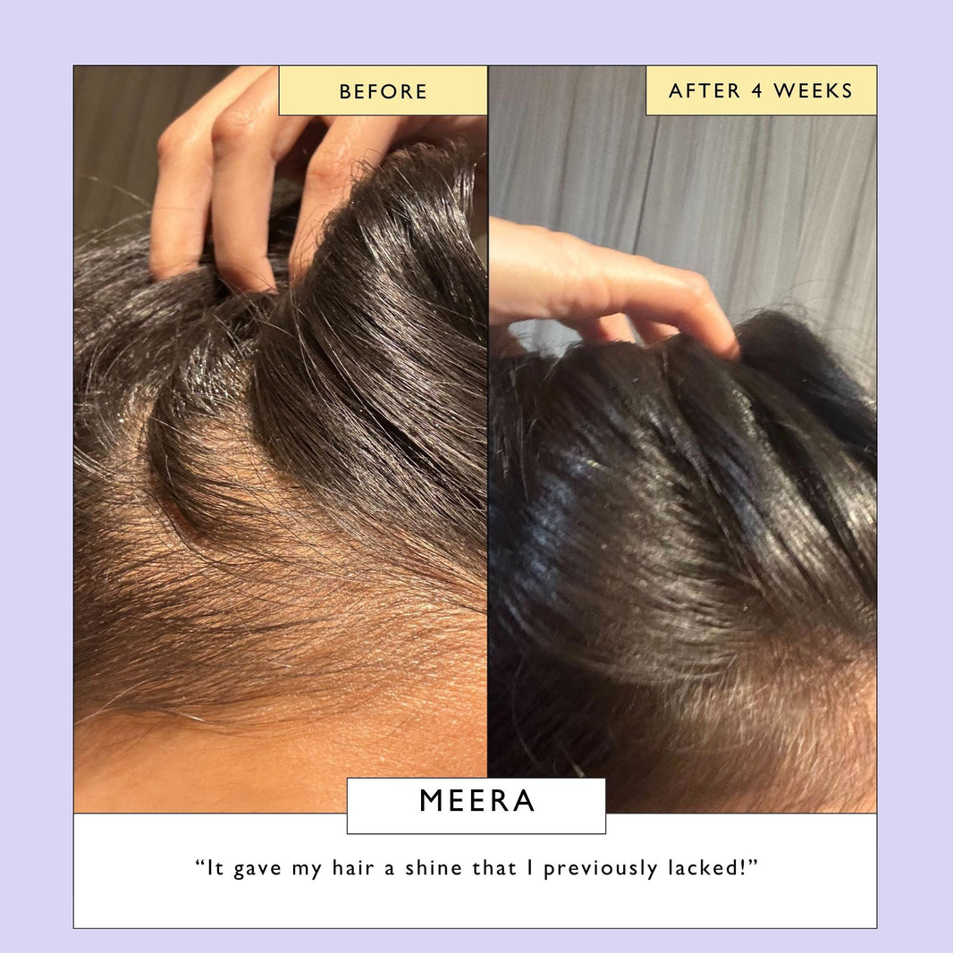 Scalp + Hair Oil with Bacuri Butter + Castor Oil-Scalp + Hair Oil with Bacuri Butter + Castor Oil