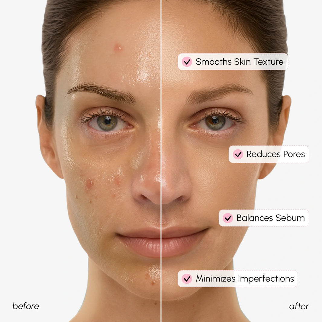 Hydrating Pore Refining Toner-Hydrating Pore Refining Toner