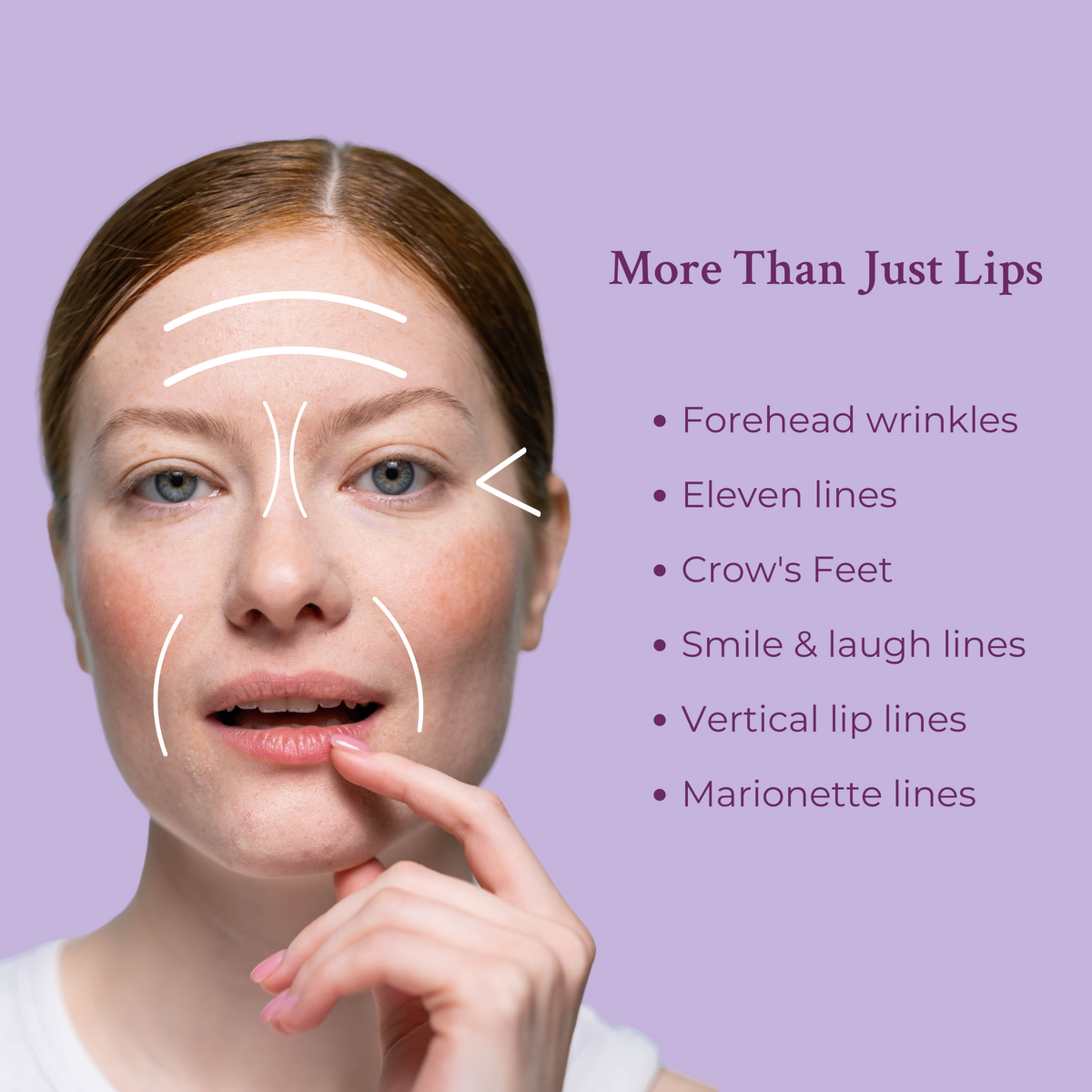 Ageless Lip & Line Filler-Ageless Lip & Line Filler