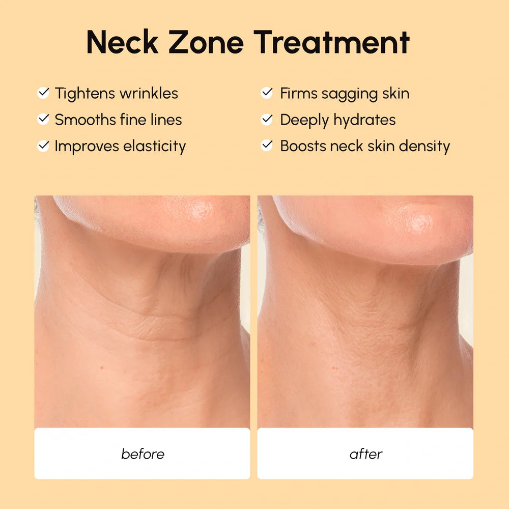 Lifting Neck Wrinkle Patches-Lifting Neck Wrinkle Patches