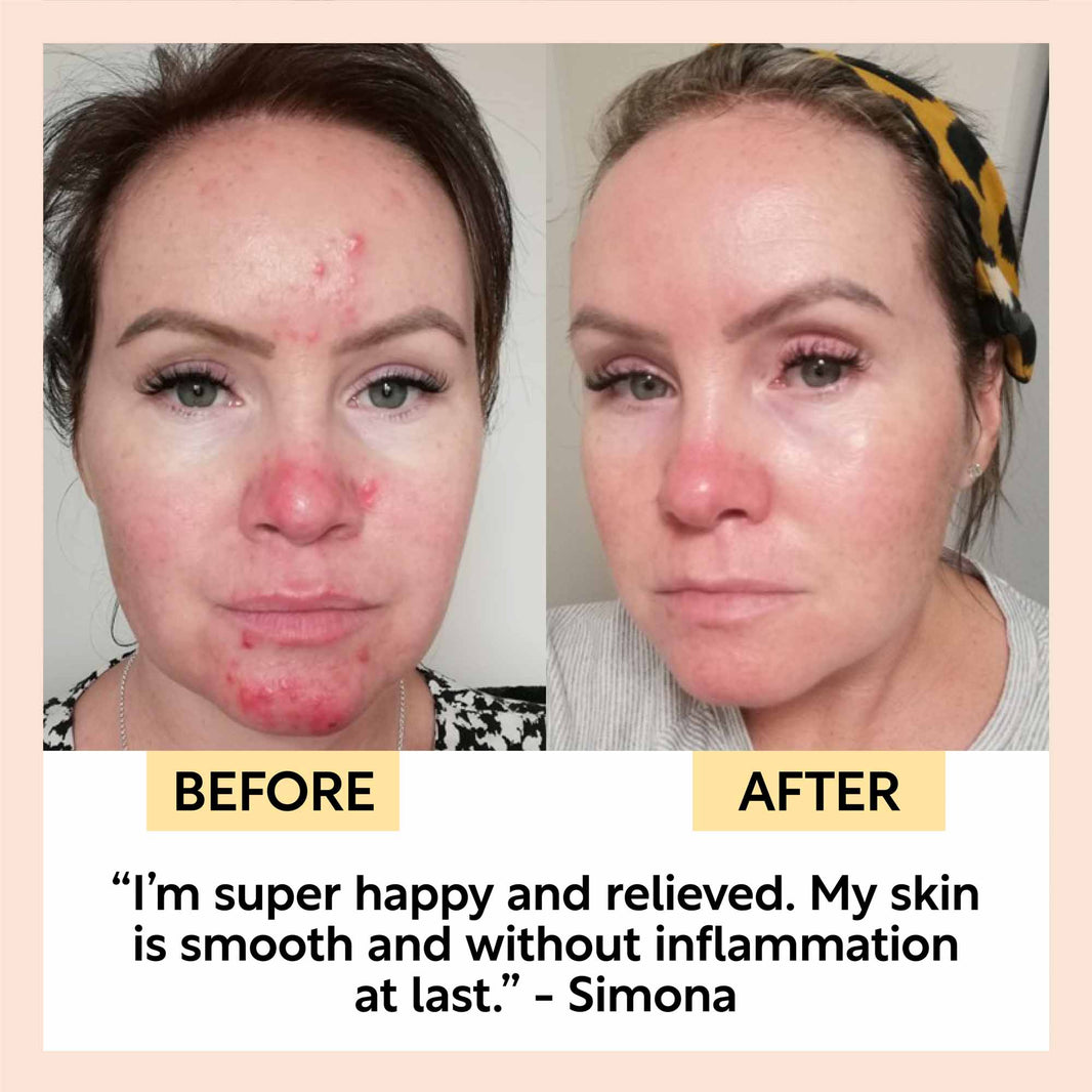 The Sensitive Skin Bundle-The Sensitive Skin Bundle