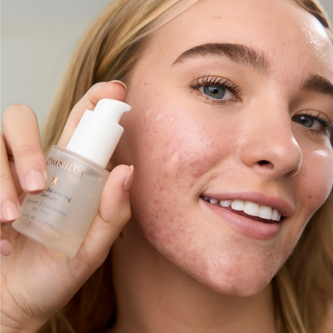 Omnilux Noni Balancing Serum-Omnilux Noni Balancing Serum