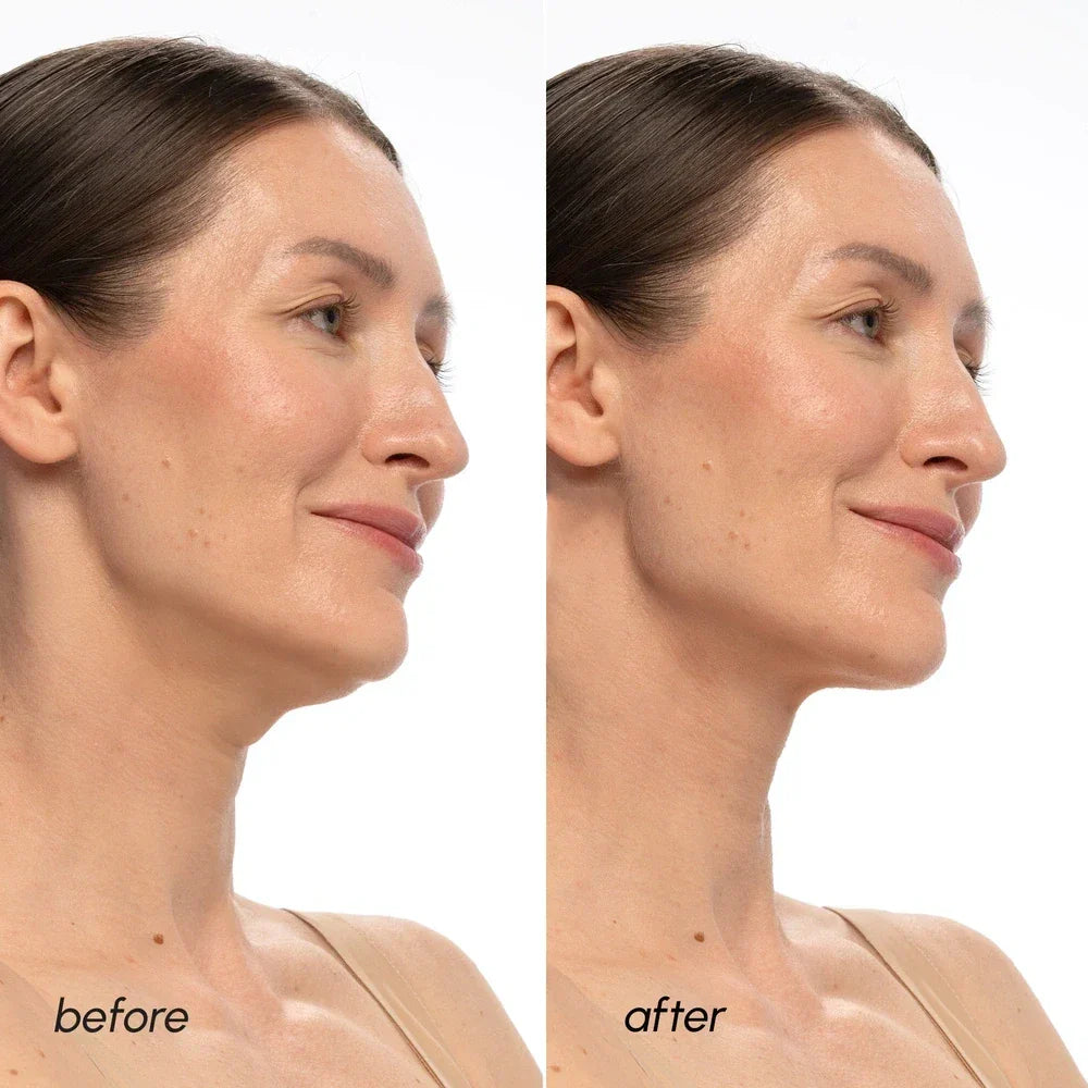 PDRN V-line Lifting Mask-PDRN V-line Lifting Mask