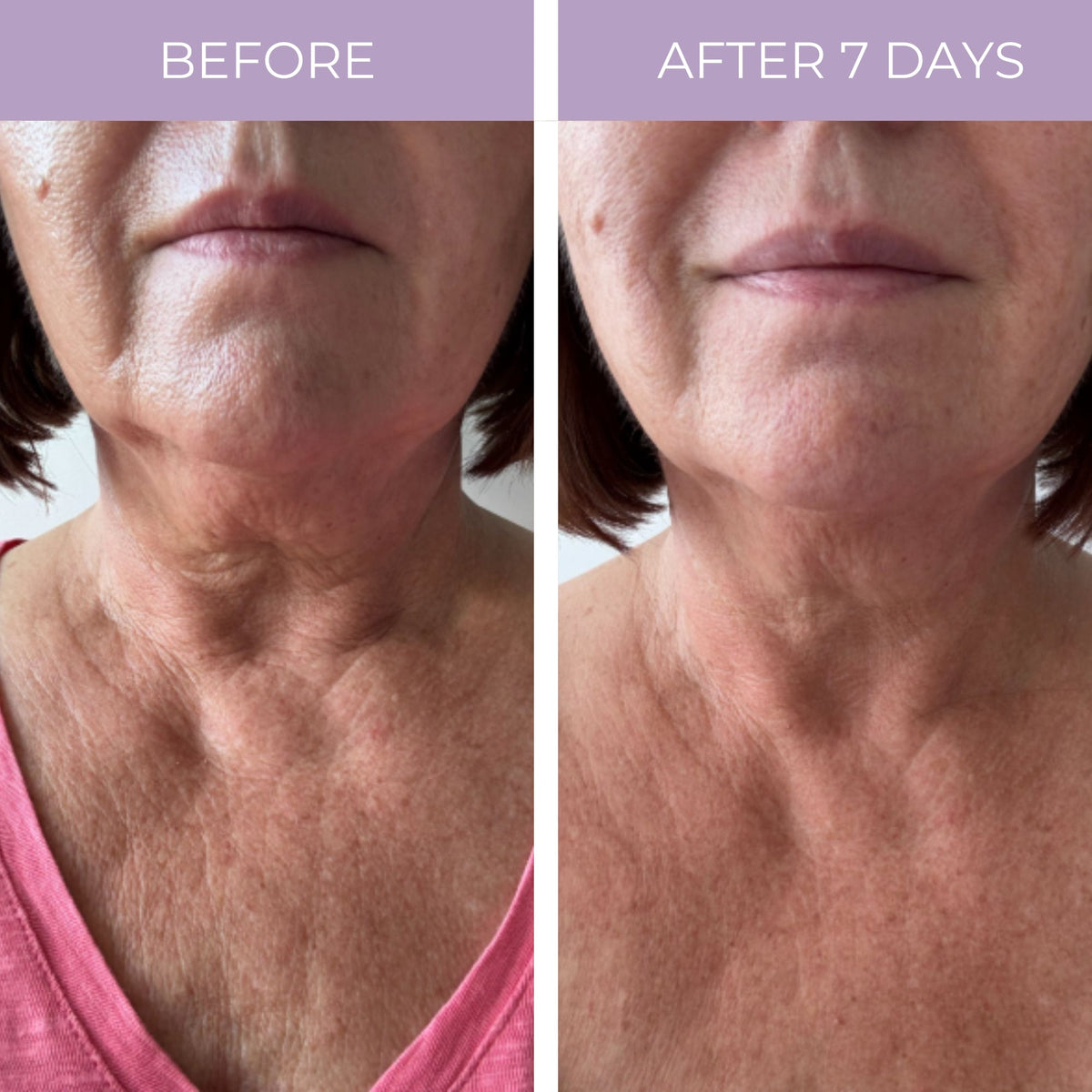 Ageless Throat & Decolletage Anti-Aging Neck Creme-Ageless Throat & Decolletage Anti-Aging Neck Creme