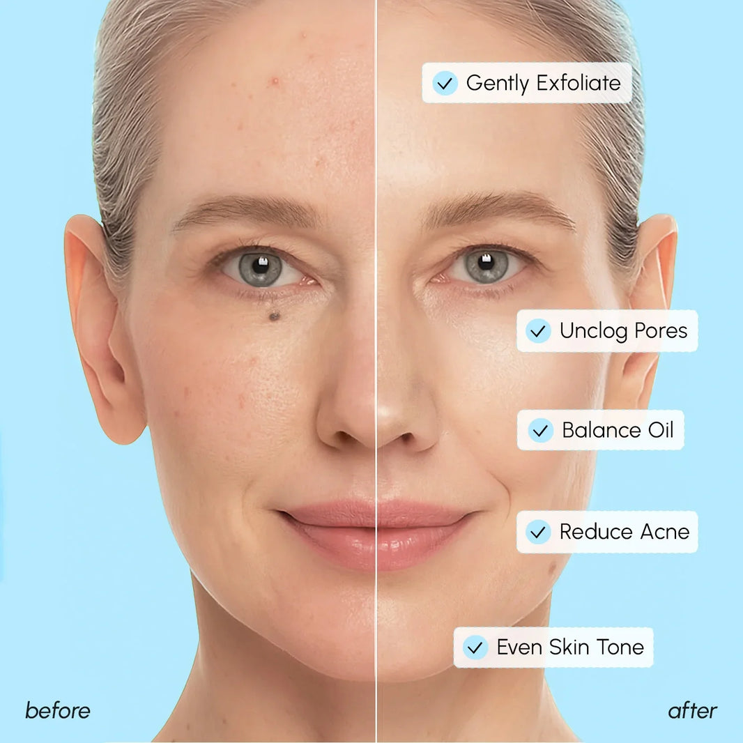 Glycolic & Salicylic Acid Peel Pads-Glycolic & Salicylic Acid Peel Pads