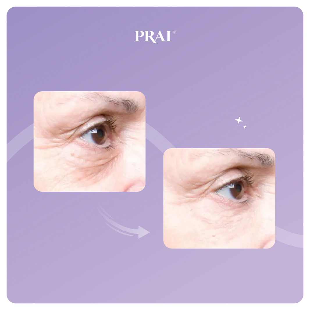 Ageless Eye Tight Uplift Serum-Ageless Eye Tight Uplift Serum